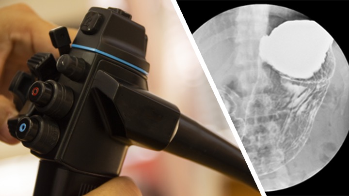 鎮静剤を使用した内視鏡検査