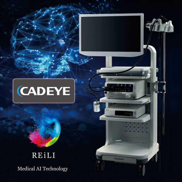 内視鏡診断支援システムCADEYE