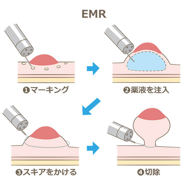 EMR