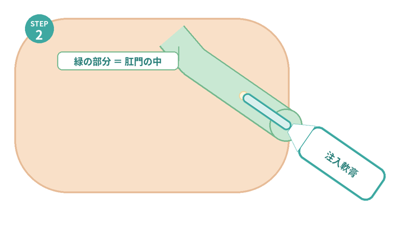 胃カメラ