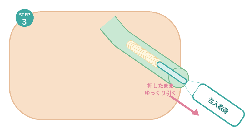 胃カメラ