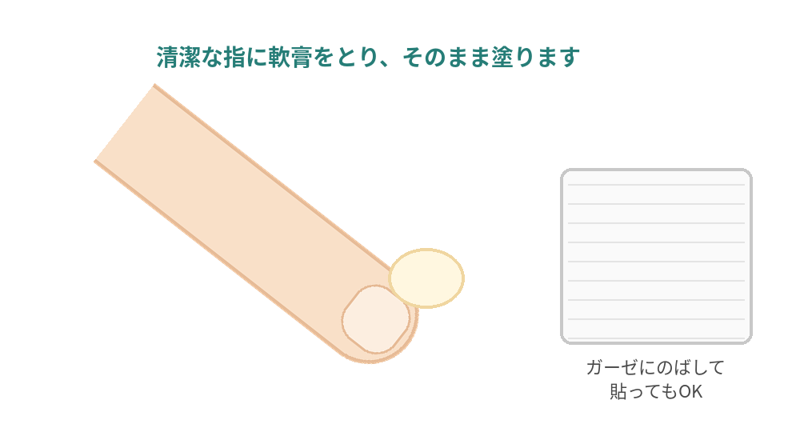 胃カメラ