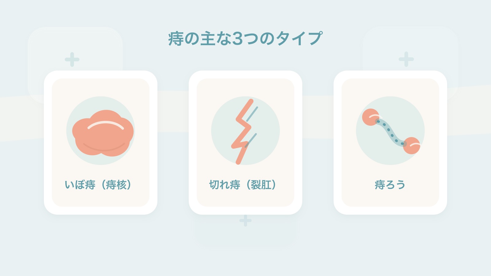 痔の3つのタイプの違いを示すイメージ図